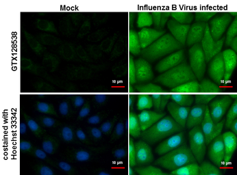 Anti-Influenza B virus Nucleoprotein antibody used in Immunocytochemistry/ Immunofluorescence (ICC/IF). GTX128538